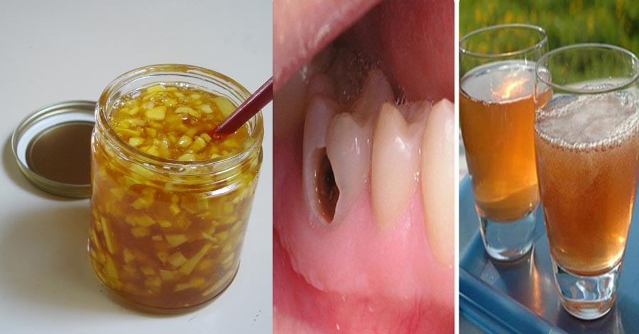 Đau nhức, sâu răng ê buốt không ngủ được sẽ khỏi ngay nhờ ngậm thứ này 15 phút