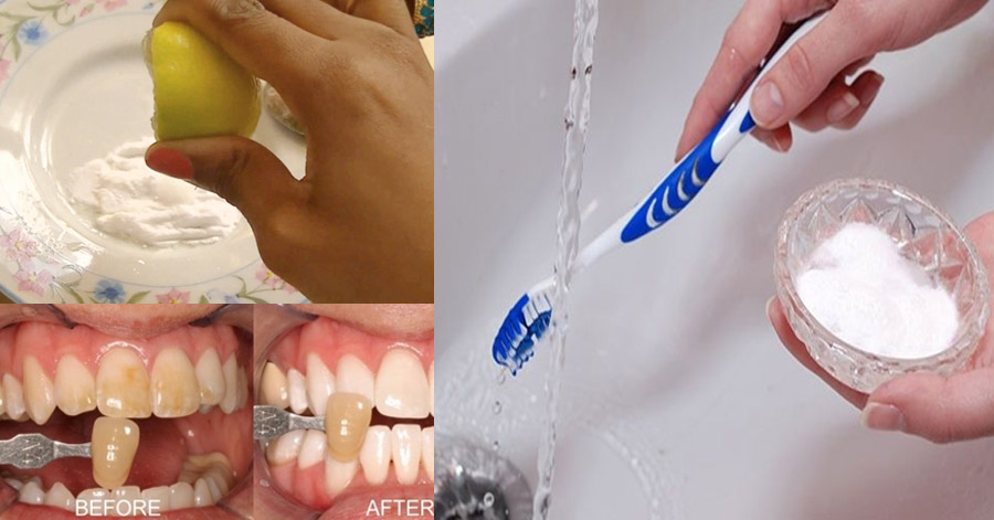 Chà chanh với thứ này, mảng bám, vết ố răng bay sạch, răng trắng đều như đi nha sĩ
