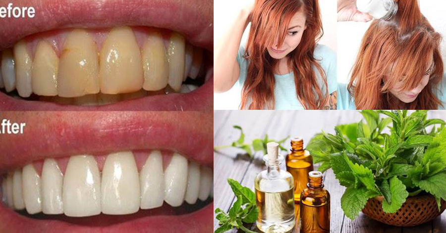 Năm 2017 rồi mà không biết 4 mẹo làm đẹp này thì không đẹp lên được đâu nhé các cô gái
