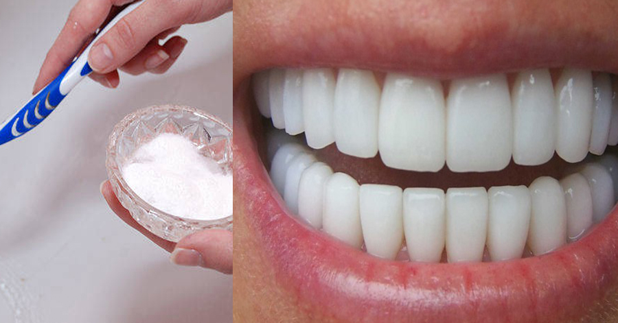 Răng trắng sáng hết ố vàng, cao răng bong thành mảng hơi thở lại thơm mát với chai oxy già