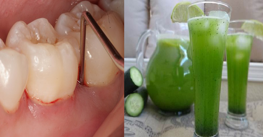 Có mẹo này, "răng lung lay sắp gãy" cũng chắc khỏe, nhai đá cũng được