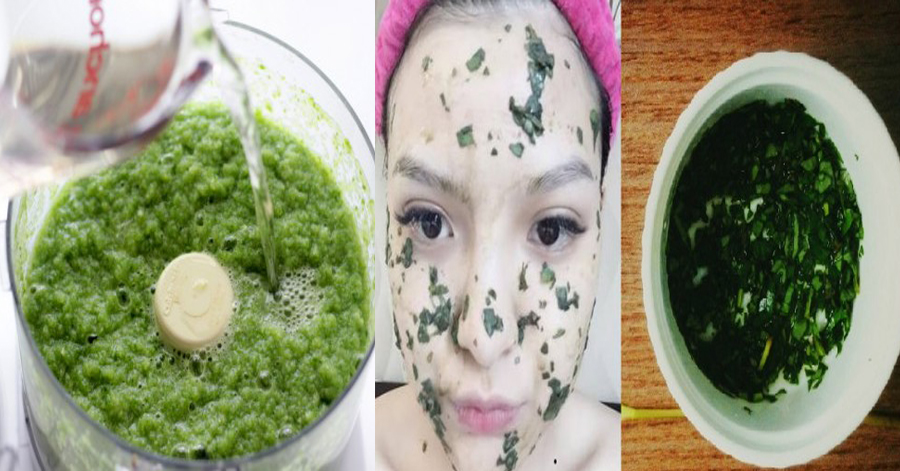 Thoa ngay hỗn hợp này mụn đầu đen sẽ biến mất mà không cần nặn