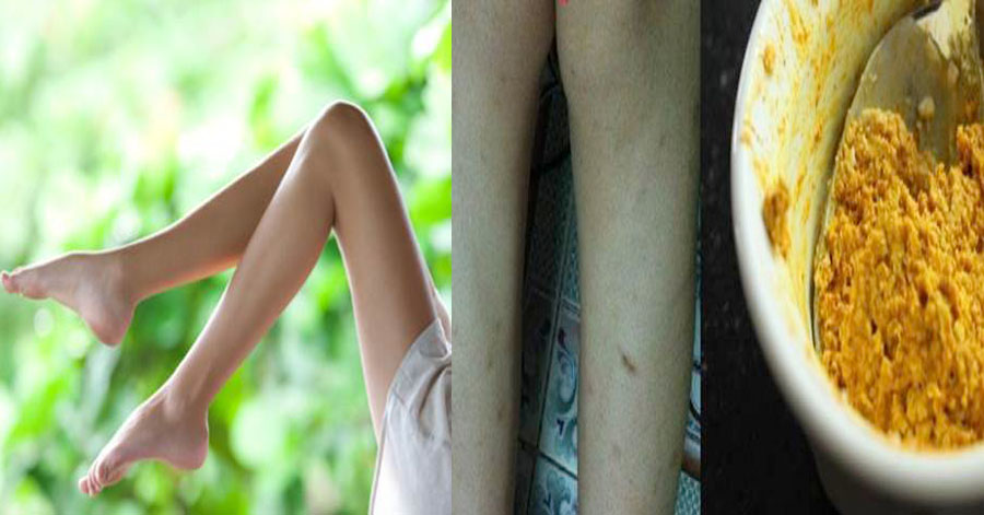 Da nhiều vết thâm đen đến đâu cũng trở nên trắng mịn nhờ đắp hỗn hợp quen thuộc này