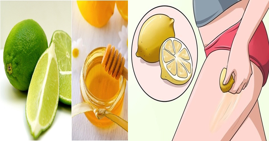 100 mẹ bầu đã thử và thành công với cách trị rạn da sau sinh này