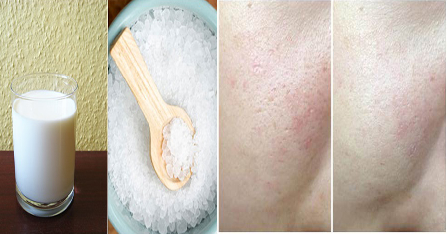 3 bước đơn giản khiến lỗ chân lông se khít lại, cải thiện làn da mịn đẹp hơn