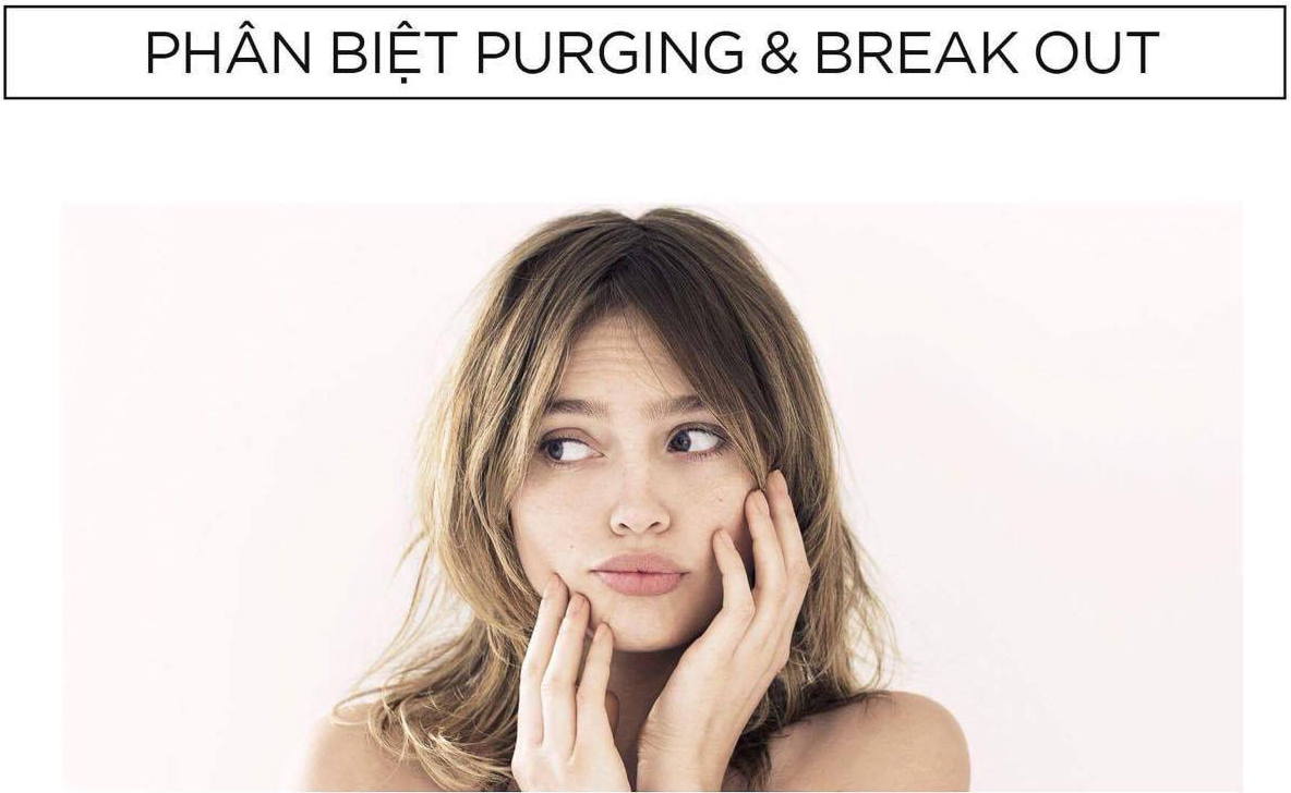 Đừng nhầm lẫn đẩy mụn với nổi mụn, kích ứng, dị ứng khi dùng AHA/BHA/Retinoids