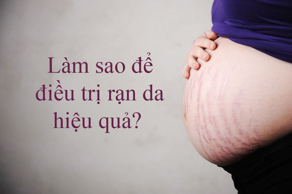 REVIEW KEM DƯỠNG CHỐNG RẠN DA NGỪA SẸO DR SPILLER S CARE CREAM