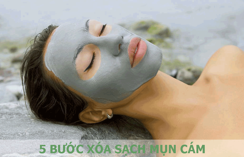 5 BƯỚC ĐƠN GIẢN ĐỂ XÓA SẠCH MỤN CÁM NGAY TẠI NHÀ