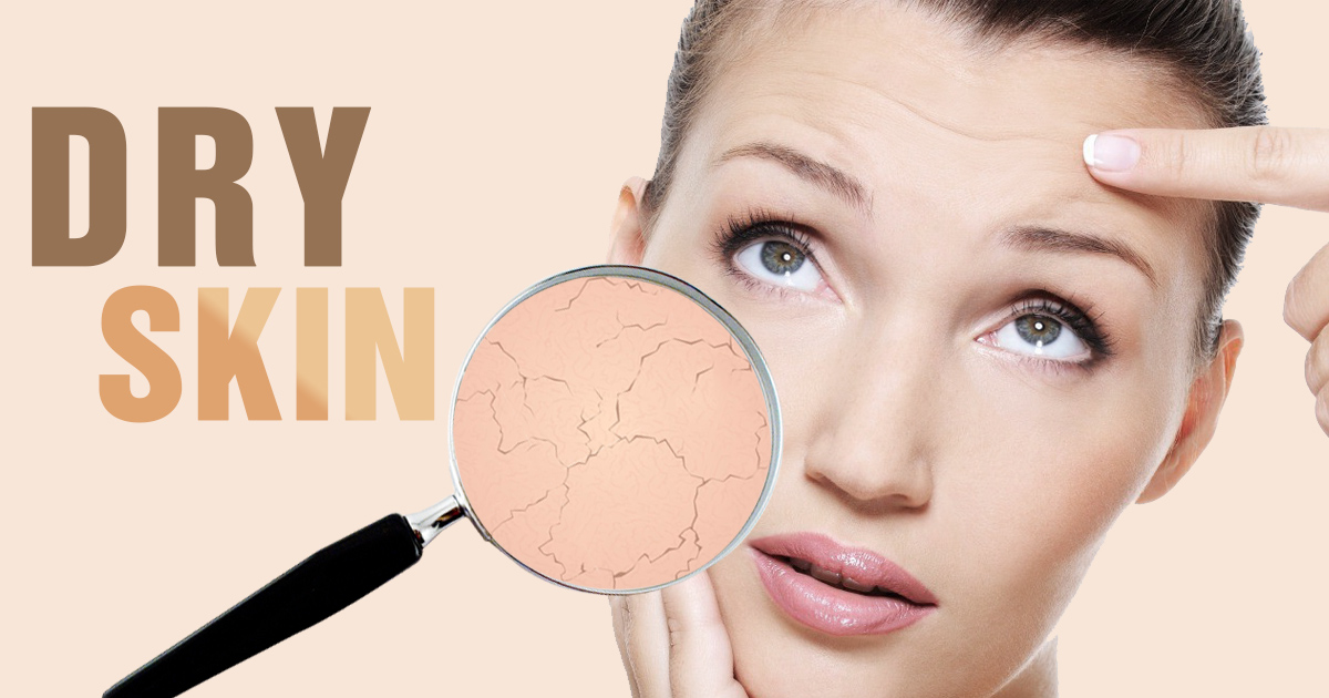 Chăm sóc da khô đúng cách – Bí quyết giúp da luôn căng mịn và đầy sức sống!