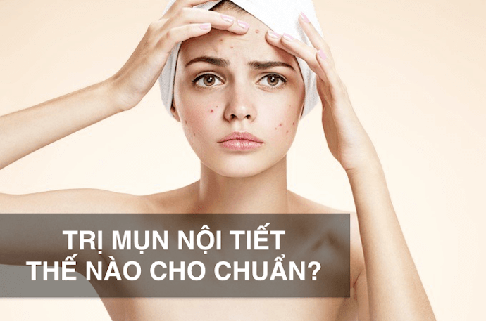 Đối phó với MỤN NỘI TIẾT - không khó nhưng cần có phương pháp CHUẨN