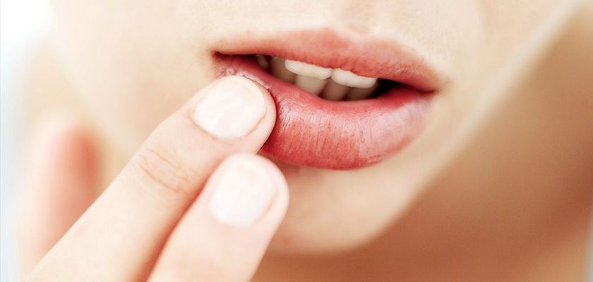 ĐỂ "NỤ CƯỜI LUÔN TỎA NẮNG", HÃY NHỚ BẢO VỆ ĐÔI MÔI KHỎI NẮNG MẶT TRỜI ĐÃ NHÉ!