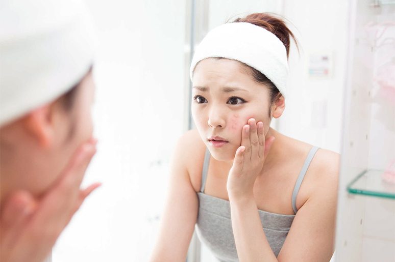 HÃY CHẮC CHẮN NÀNG ĐÃ CHĂM SÓC DA MỤN ĐÚNG CÁCH?
