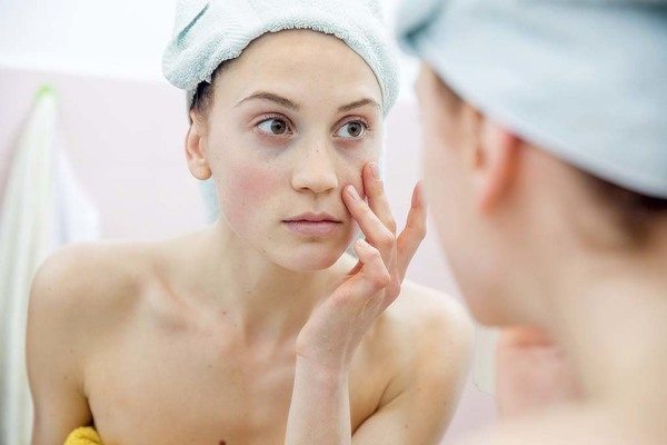 MẸO CHĂM SÓC DA KHÔ BỊ MỤN, NÀNG PHẢI BỎ TÚI MÙA ĐÔNG NÀY