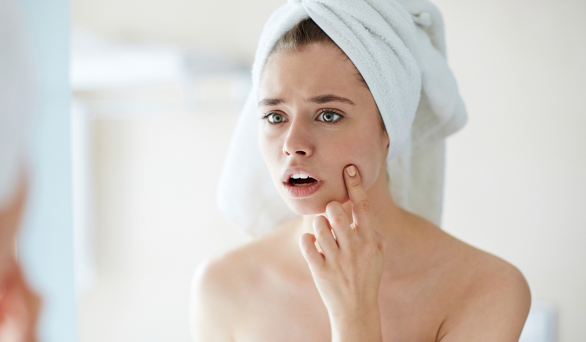 Khám phá ngay các sản phẩm trị mụn “thần tốc” được các tín đồ làm đẹp tin tưởng