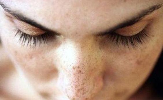 CÀNG LỚN TUỔI CÀNG DỄ BỊ NÁM, TẠI SAO?