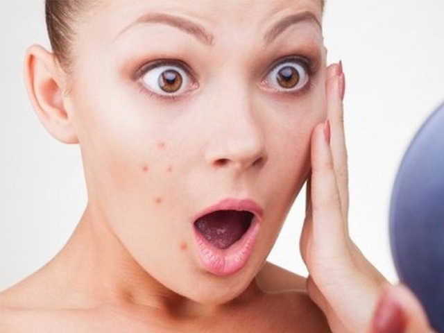 Mụn nang lông là gì? Nguyên nhân và giải pháp điều trị
