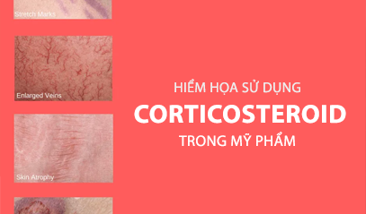 Hiểm họa từ việc sử dụng kem Corticosteroid lâu dài và liên tục cần biết