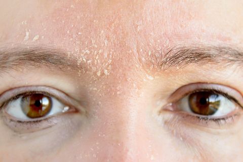 9 lời khuyên từ chuyên gia giúp giải quyết triệt để da khô và ngứa