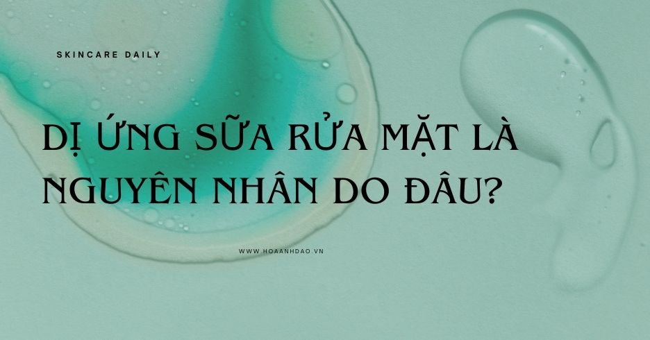 Giải đáp thắc mắc về nguyên nhân dị ứng sữa rửa mặt?