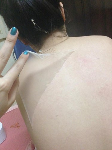 hiểm họa từ việc tắm trắng
