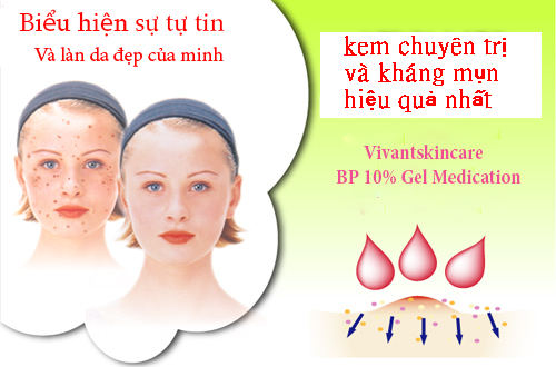 kem giúp giảm mụn vivantskincare hạ gục mụn hiệu quả cao