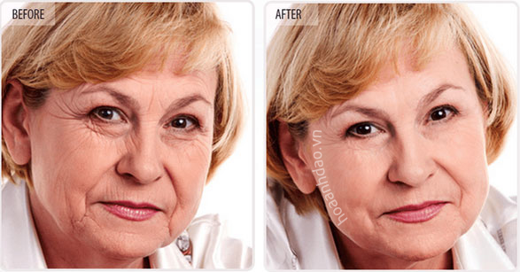 Serum ngừa lão hóa Image Skincare Ageless Total Anti Aging Serum giúp cải thiện độ đàn hồi, cho làn da căng mịn, ngừa nếp nhăn hình thành, giúp da săn chắc và tươi trẻ trông thấy.