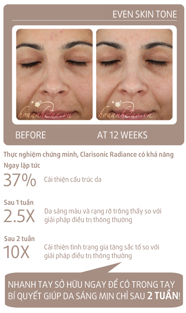 may-rua-mat-clarisonic-mia-3-sonic-radiance-brightening-solution-hoaanhdaovn