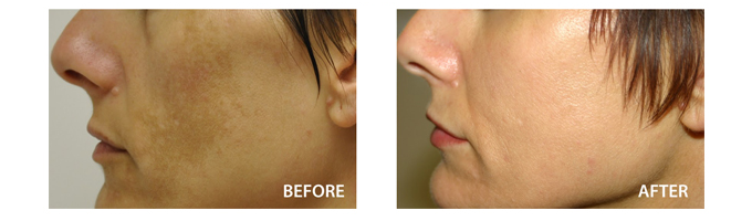 is-clinical-c-e-serum-advance-chong-lao-hoa-tri-sac-to-lam-sang-san-chac-da