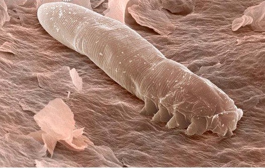 khuan ghe demodex