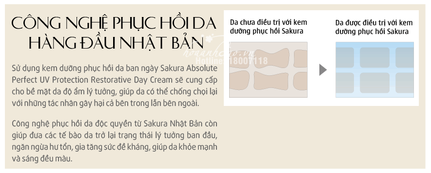 bo-kem-duong-chong-lao-hoa-phuc-hoi-da-sakura-hoaanhdaovn
