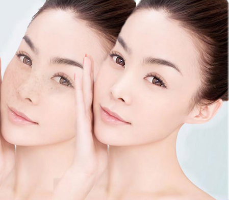 Kem giúp giảm nám, tàn nhang dạng gel - SYMA