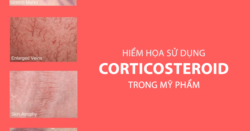 hiem-hoa-tu-viec-su-dung-kem-corticosteroid-lau-dai-va-lien-tuc-can-biet